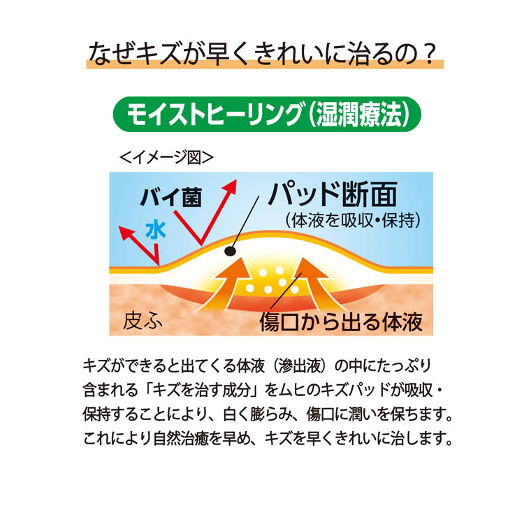 アンパンマン キャラクター ムヒのキズパッド ( 10枚入 )/ ムヒ