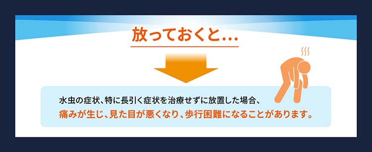 予約販売品 ラミシールプラス クリーム 10g セルフメディケーション税制対象 水虫治療薬 かゆみどめ成分 白癬菌を殺菌 