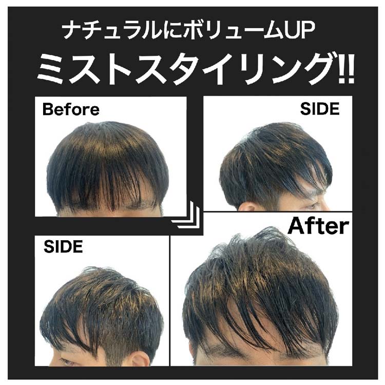スーパーミリオンヘアミスト ( 100ml×6セット )/ スーパーミリオンヘア