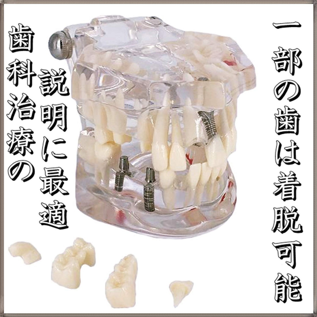 【最終出品8/9】インプラント模型 000000052180_u67se4N.jpg
