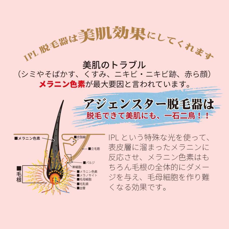 脱毛器 IPL光脱器 永久脱毛 家庭用脱毛器 自動照射 レーザー vio対応