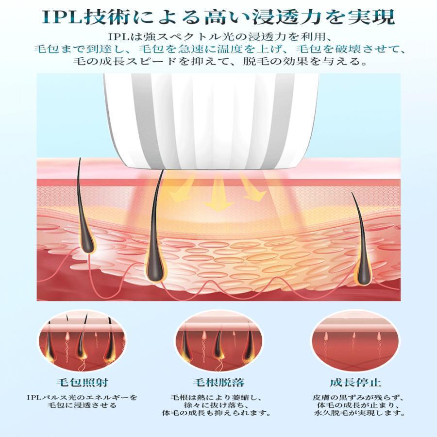 脱毛器 IPL光脱器 永久脱毛 家庭用脱毛器 自動照射 レーザー vio対応