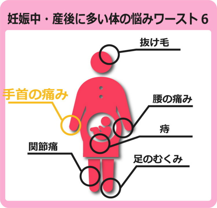 手首サポーター 腱鞘炎 ローズマダム 産後ケア 抱っこ 授乳 育児 マタニティ 産前 産後 腱鞘炎 サポーター 手首サポーター 手首の痛み しびれ Rosemadame 854 0026 02 Stampskids 通販 Yahoo ショッピング