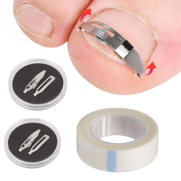 .装飾ソースフォンダン鉛筆フィルター