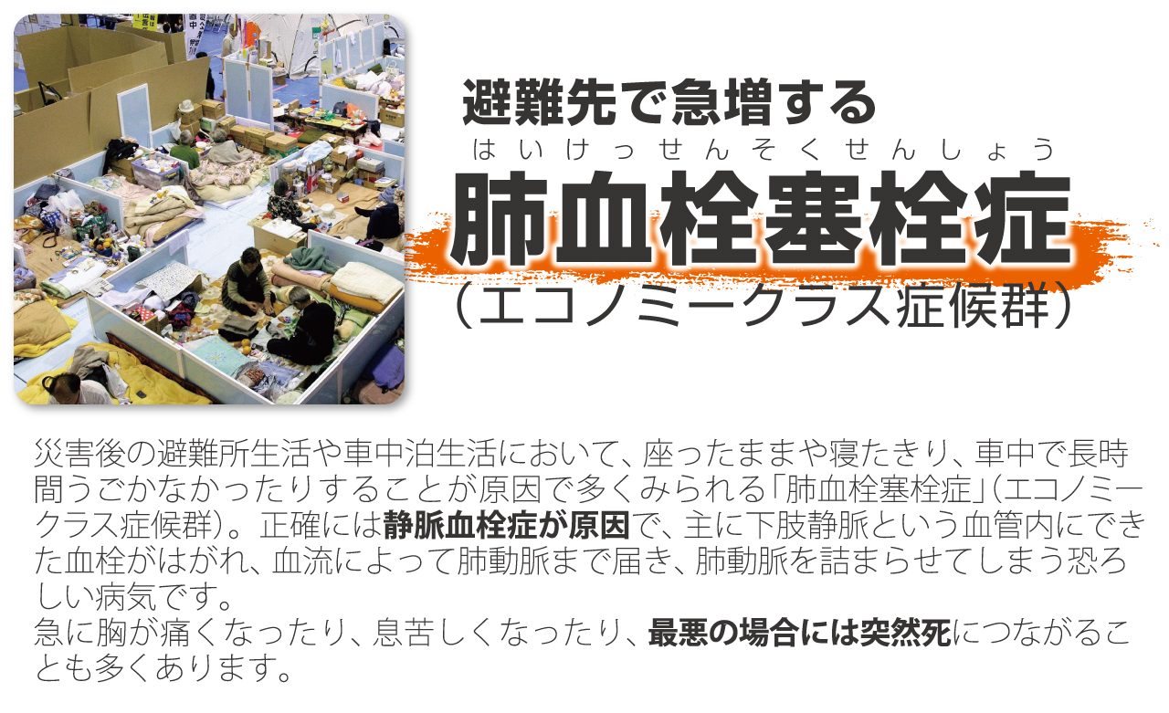 避難先で急増する肺血栓塞栓症