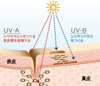 年齢肌に影響する二つの紫外線