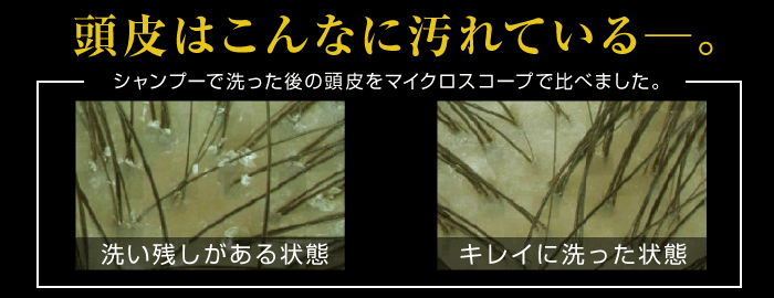 頭皮爽快スカルプブラシ 着後レビューで 送料無料