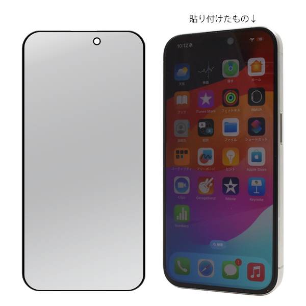 fip15p-glpv-06.jpg