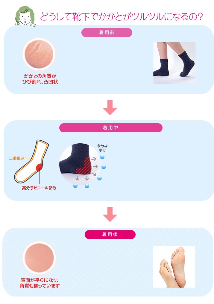 Rakuten 10足組 奈良のくつした かかとツルツルソックス かかとガサガサ ひび割れ 角質除去 かかと靴下 冷え性 足元冷え 22 24cm 太陽ニット 激安単価で Www Muslimaidusa Org