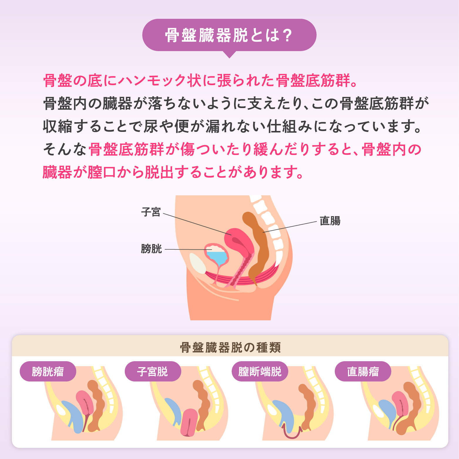 骨盤底筋サポーター