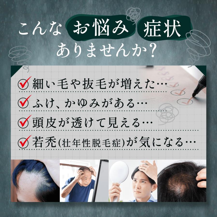 ニューモ 公式 ニューZ 薬用 育毛剤 発毛剤 60ml 1本 第二類