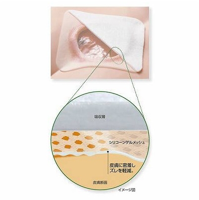 エスアイエイド （50枚入） 3号 幅7.5×7.5cm 湿潤療法 やけど治療