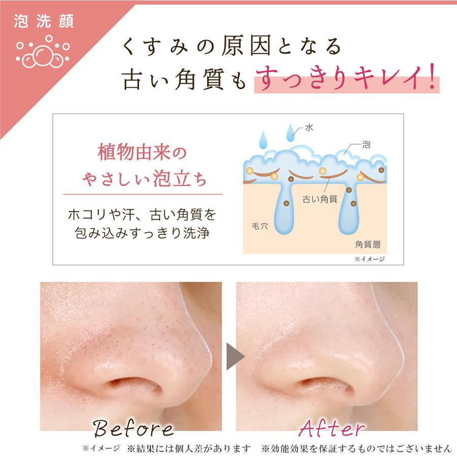 nopa（ノパ）トリートメントインクレンジングフォームフレスカーノ