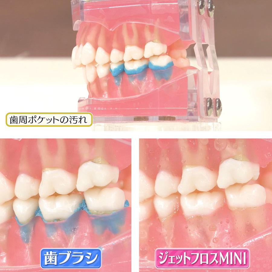 ジェットフロスMINI / 舌クリーナーノズル付き ヤーマン YOI-1000W-1