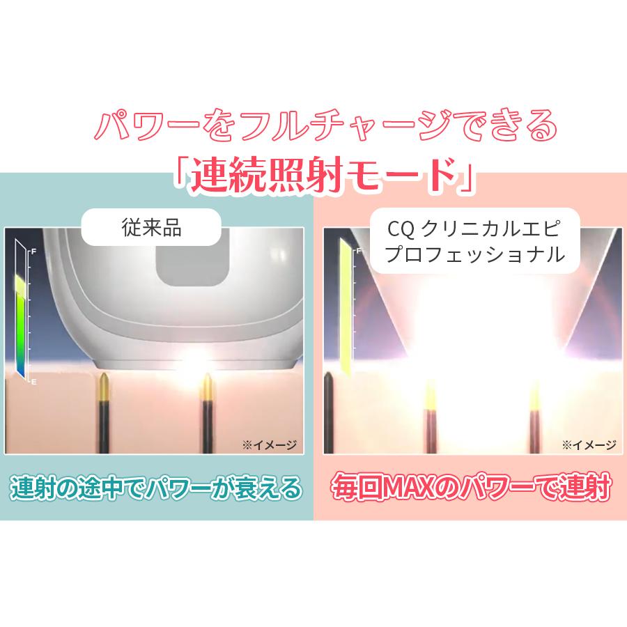 CQ クリニカルエピプロフェッショナル / ムダ毛ケアアイテム /  2449 【TBSショッピング】の画像