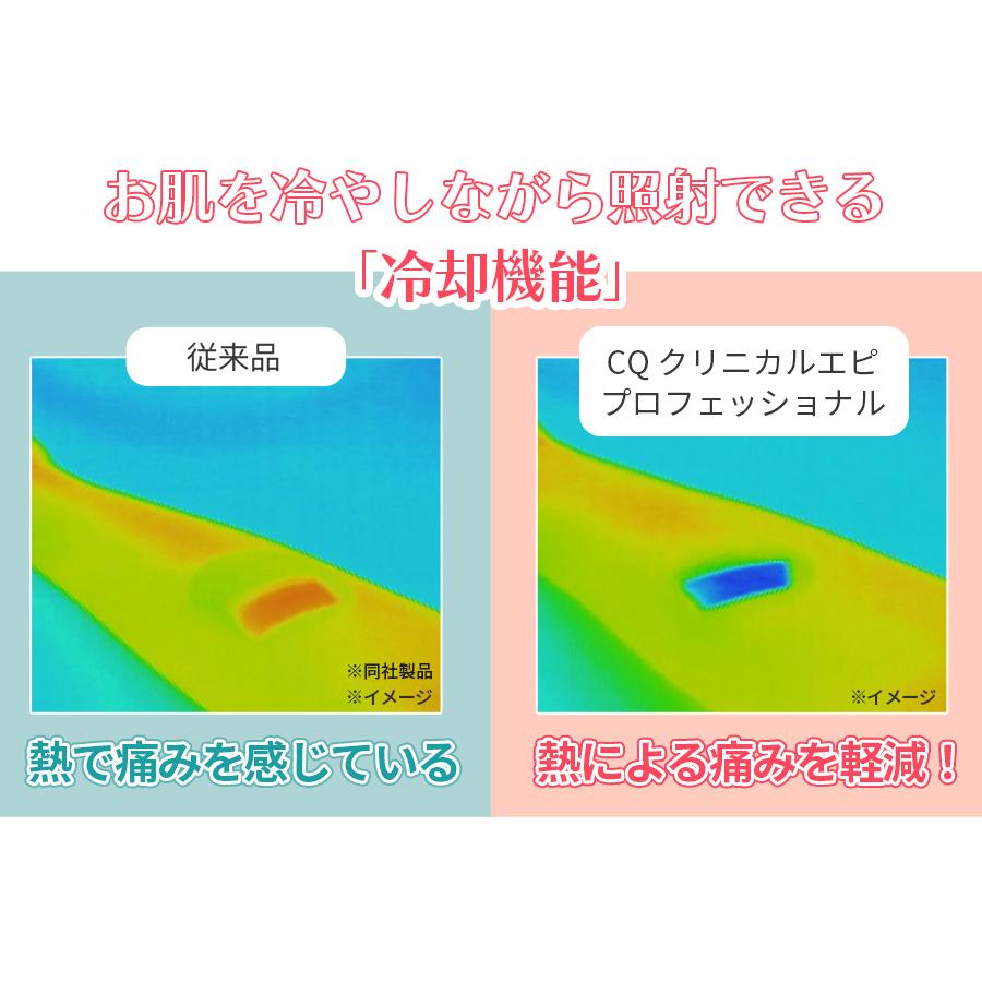 CQ クリニカルエピプロフェッショナル / ムダ毛ケアアイテム /  2449 【TBSショッピング】の画像