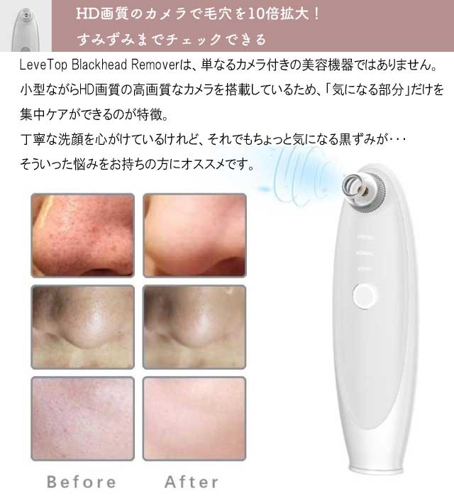 【24H以内発送✦新品未使用】ブラックヘッドリムーバー&トナー20ml ブラックヘッドリムーバー | 業務用美容・エステ機器の卸・仕入通販は