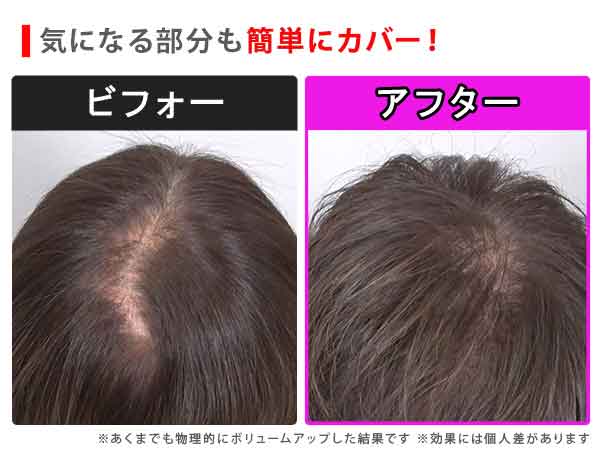 テレビショッピング商品】 メディカルヘアミスト 医薬部外品
