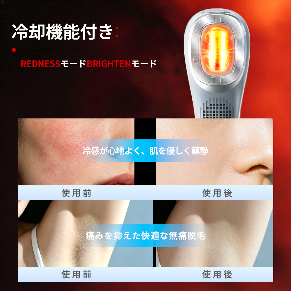 【未開封】冷却機能付脱毛器 美顔器 脱毛器 永久脱毛 DPL 美容器 美顔器 NIR 美肌 小顔効果 EMS 家庭用脱毛