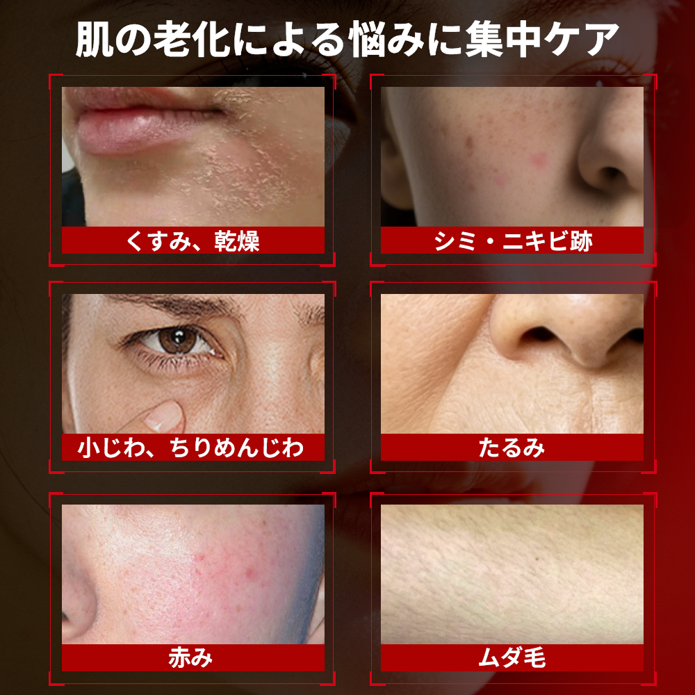 脱毛器 永久脱毛 DPL 美容器 美顔器 NIR 美肌 小顔効果 EMS 家庭用脱毛