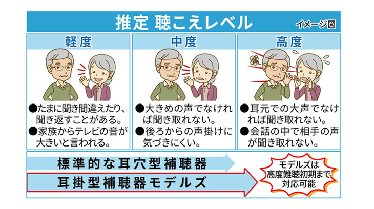 アドバンス補聴器 モデルズ 耳かけ式デジタル補...の詳細画像3