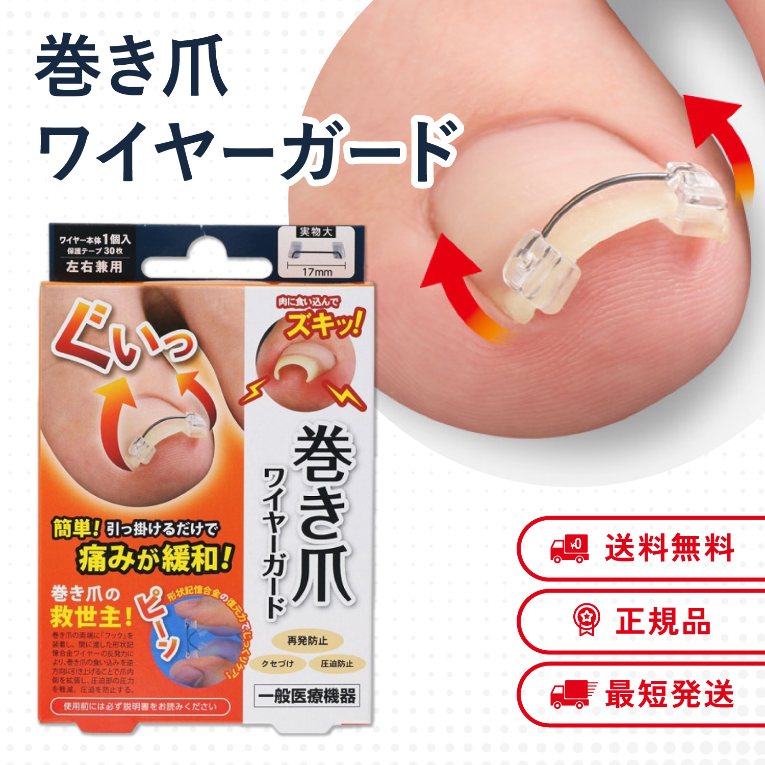 巻き爪ワイヤーガード 巻き爪 防止 予防 矯正 緩和 左右兼用 ワイヤー サイプラス | サイプラス