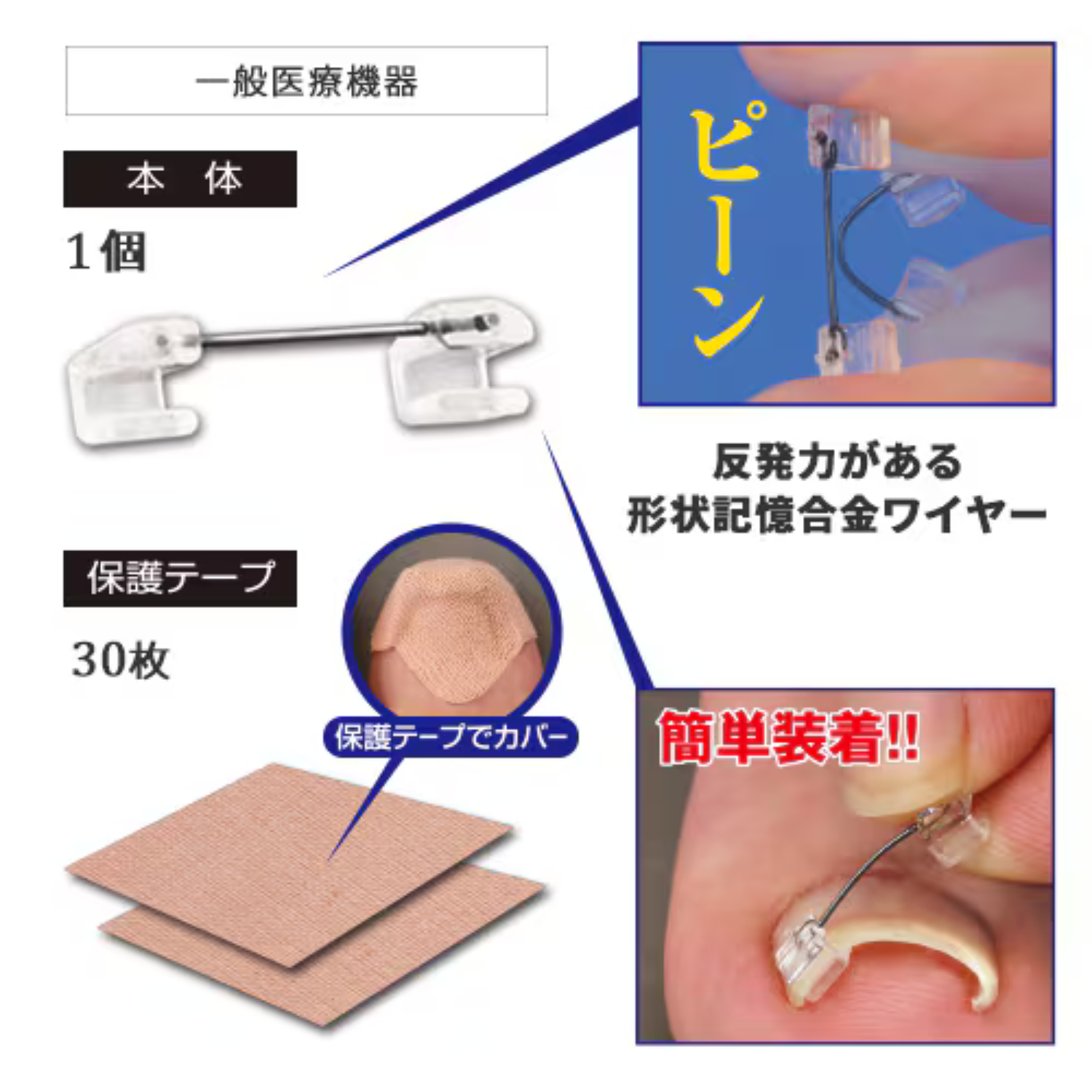 巻き爪ワイヤーガード 巻き爪 防止 予防 矯正 緩和 左右兼用 ワイヤー サイプラス | サイプラス | 02
