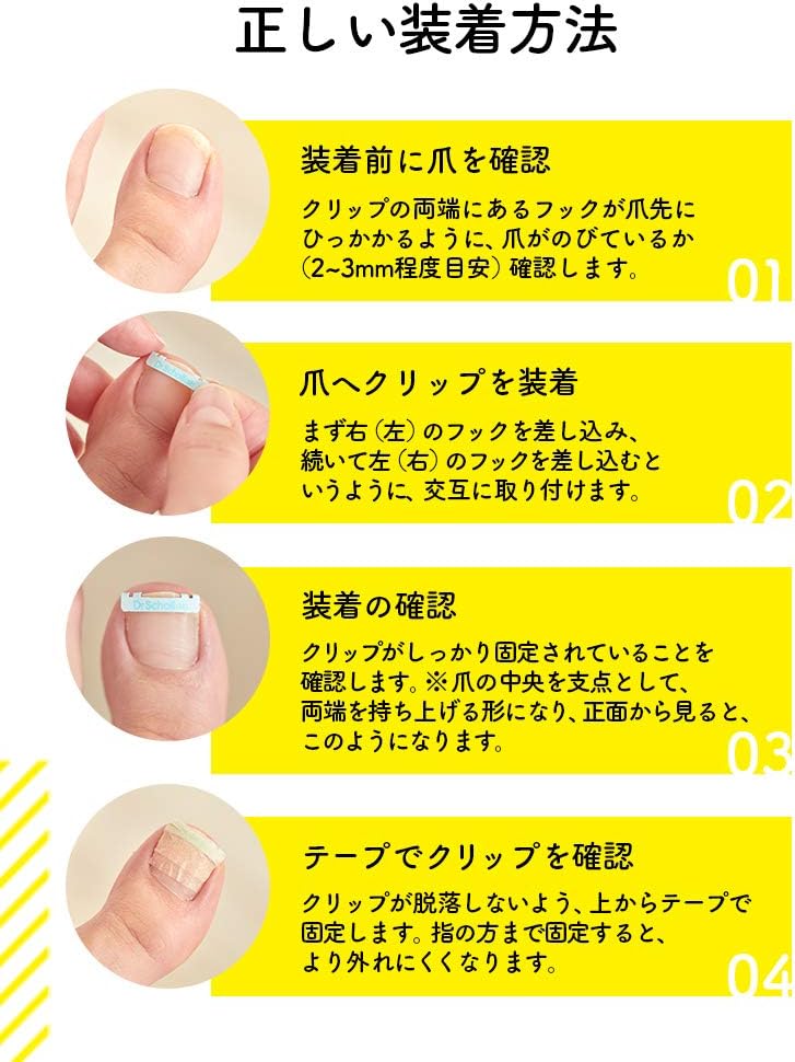 ドクターショール 巻き爪用クリップ M Mサイズ 巻き爪 矯正 クリップ | ドクターショール | 05