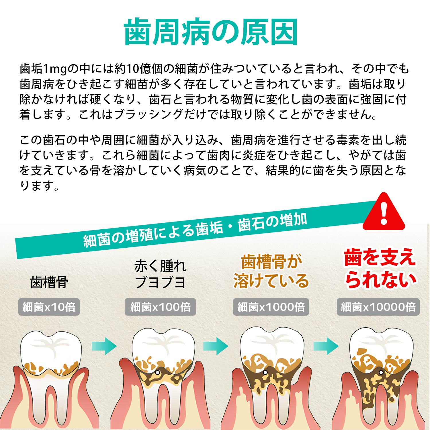 応援特価! 医療認証品 歯石取り スケーラー 歯石 スケーラー 歯 歯石除去 5点セット 自宅 デンタルケア 虫歯 予防 歯垢 歯鏡 口腔ケア ケース付 関連画像5