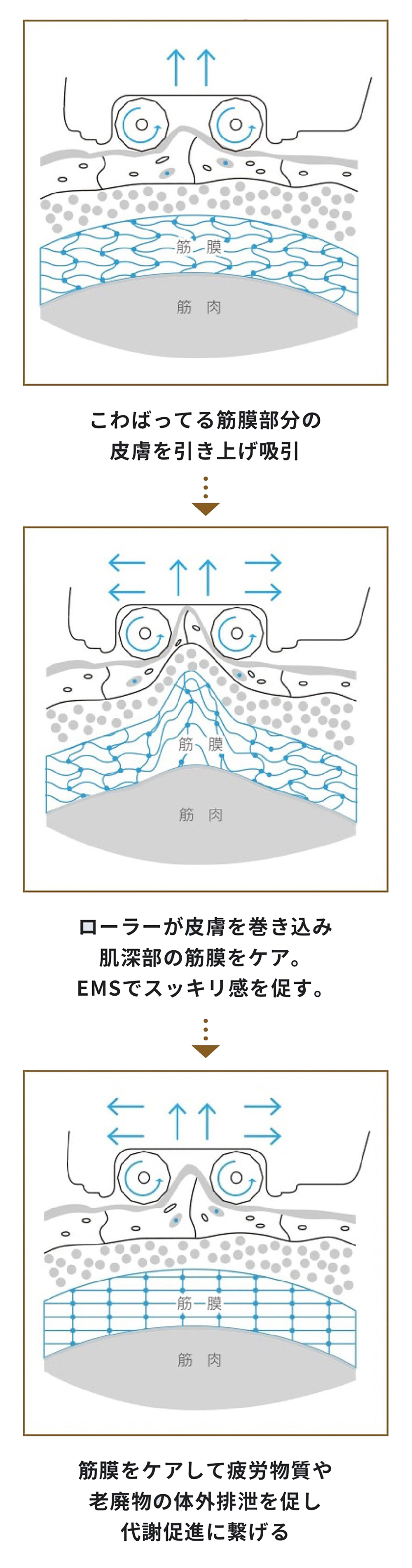 筋膜リリース 筋膜はがし 吸引 ローラー EMS マッサージ エステ