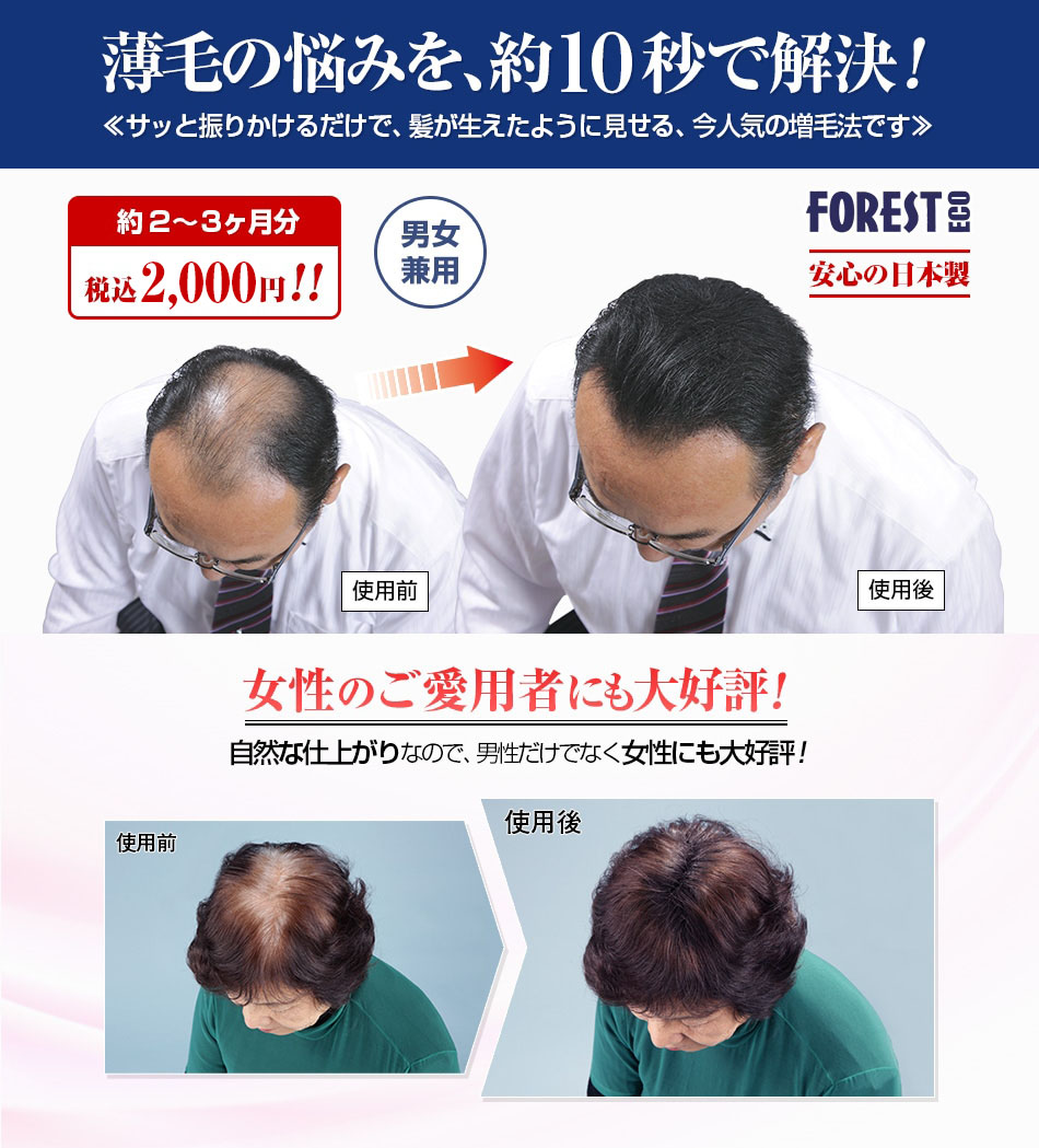 フォレスト エコ - ふりかけるだけ パウダー 増毛 毛髪 ボリューム