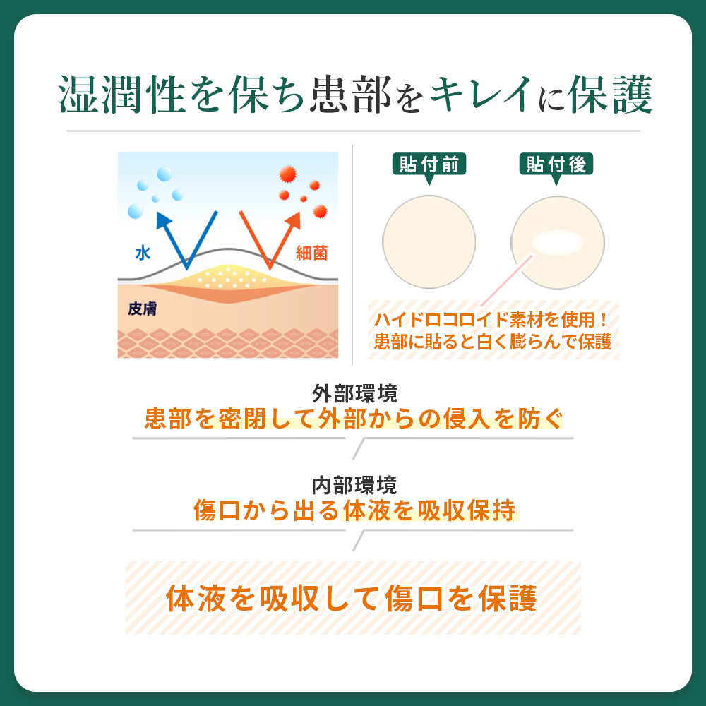 ニキビケア 背中 お尻 広範囲用 CICA配合 一般医療機器 日本製 スポットエイド ニキビ ハイドロコロイド 皮脂 角質 湿潤療法 薬用 ニキビパッチ にきび｜virginbeautyshop｜05