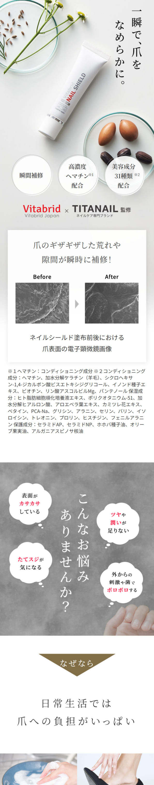 ネイルシールド