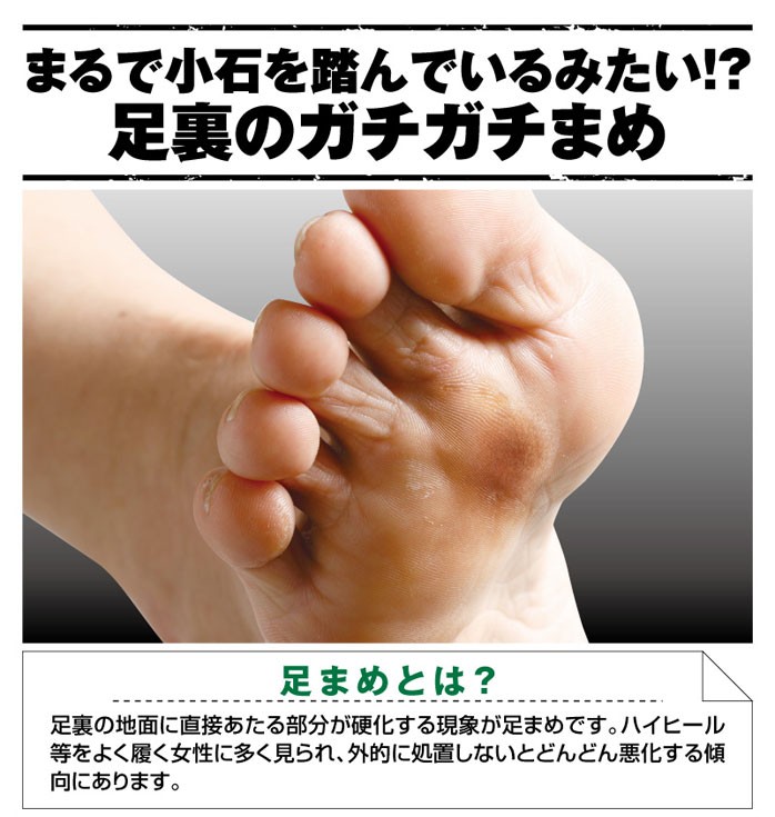 足まめ 角質除去 削らない 角質ケア 足マメ対策 底まめ 底まめ対策 足