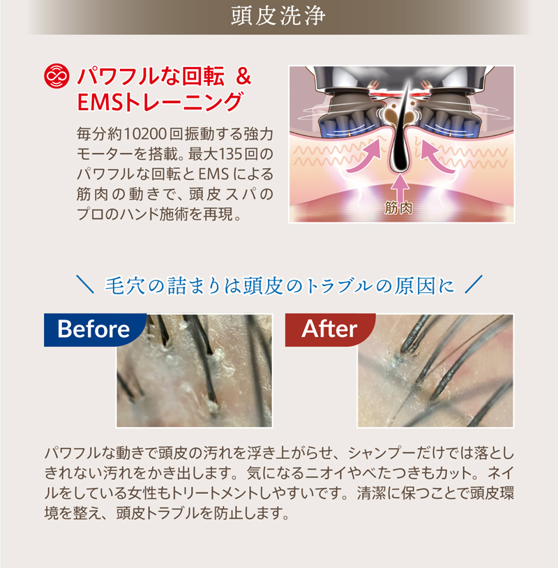 正規品 1年保証 ZOGANKIN ゾーガンキンスカルプ CL-ZKS スカルプ