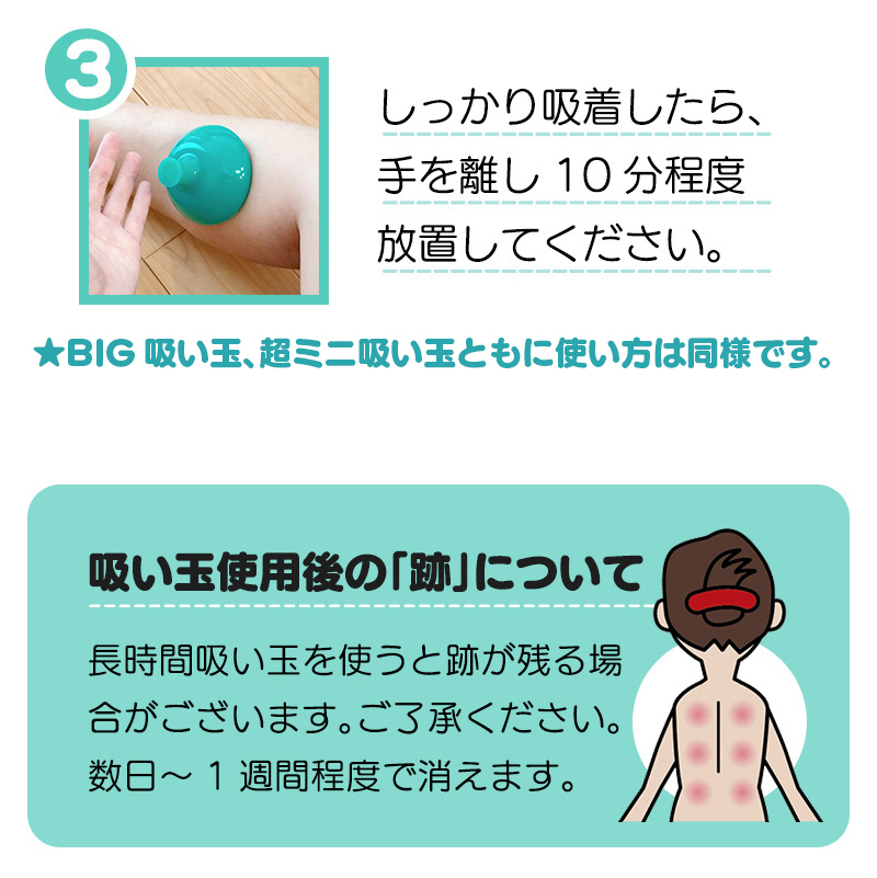 高級カッピングセット 手のひらより大きい超巨大シリコン製吸い玉+