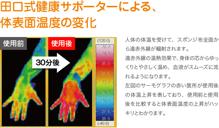 田口式健康サポーターによる、体表面温度の変化