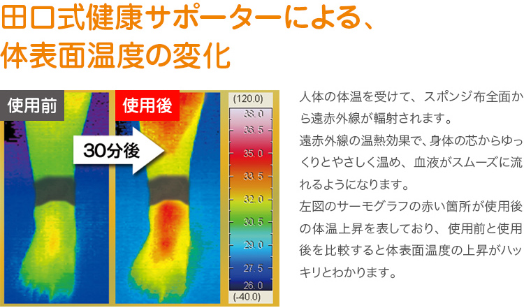 田口式健康サポーターによる、体表面温度の変化