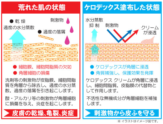 ケロデックスクリーム（本体/詰め替え：本体）の商品一覧 通販