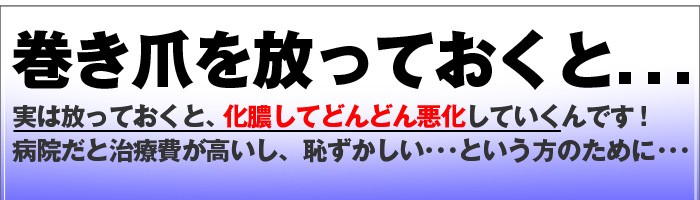 巻き爪ワイヤーガード 2箱セット 2ヶ月分