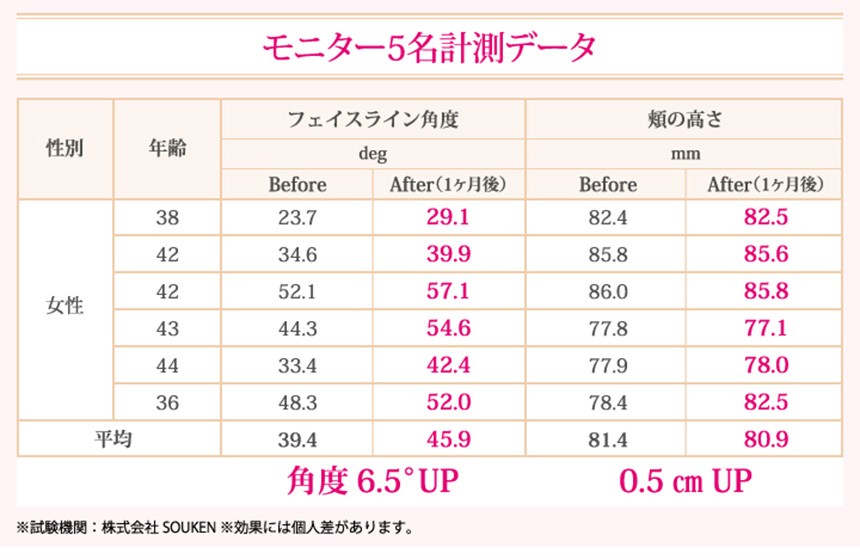 フェイシャルリフトアトワンス