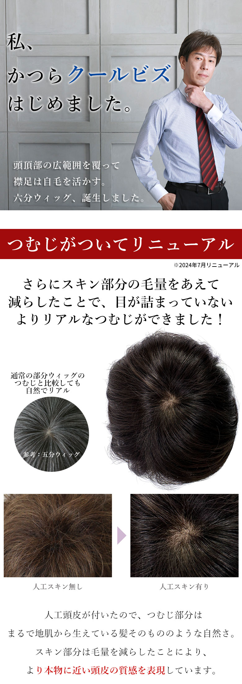 頭頂部の広範囲を覆って襟足は自毛を活かす、六分ウィッグ誕生