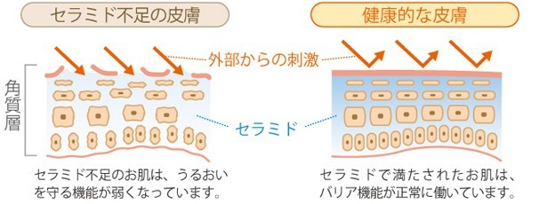 肌図