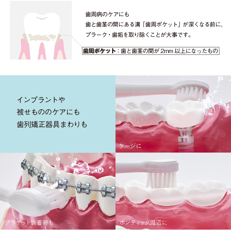 EMS 頭皮ブラシ 美顔器ブラシ スカルプブラシ Pro ems