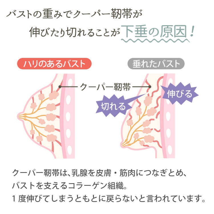 バストの重みでクーパー靭帯が伸びたり切れることが下垂の原因