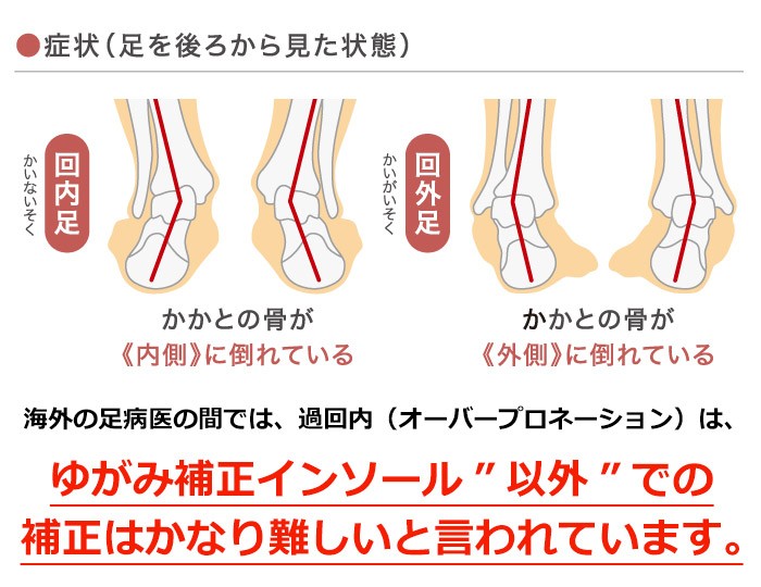 Top Deal [トップディール] ゆがみ補正 ゴルフ用 インソール 【ロング