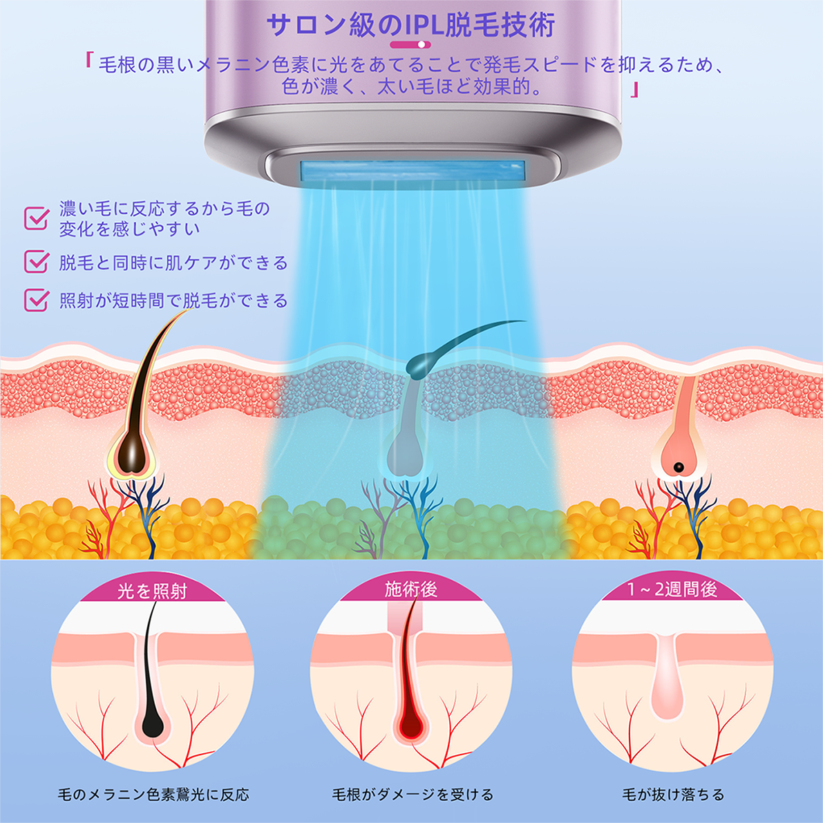 脱毛器 IPL 光美容器 冷却 脱毛 美肌 全身脱毛 サロン級 光脱毛器 脱毛機 自動照射 冷感 冷却機能