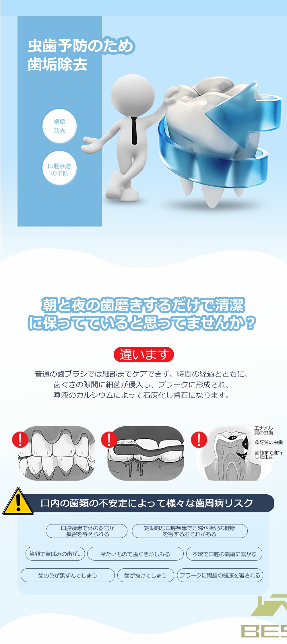 歯石取り 超音波口腔洗浄器 内視カメラ搭載 超音波スケーラー 超音波歯