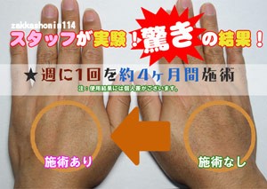 ライトエピ ハンディタイプ フラッシュ式 脱毛器 送料無料 : epi-01 : zakkashonin114 雑貨商人 - 通販 -  Yahoo!ショッピング