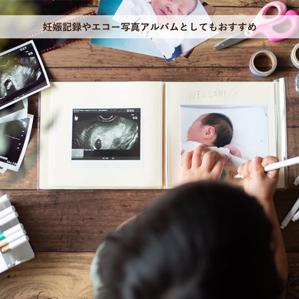 エコー写真にも